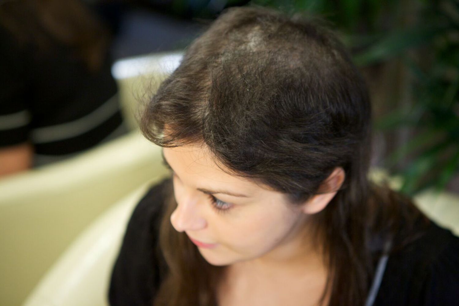 ocd and hair pulling